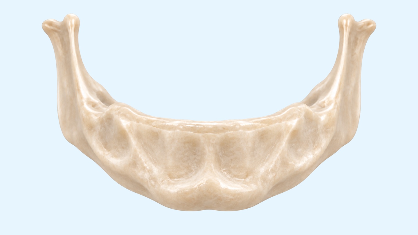 İstanbul'da All-on-4 implant: All-on-4 implantların nasıl yerleştirildiğini gösteren alt çene 3D çizimi