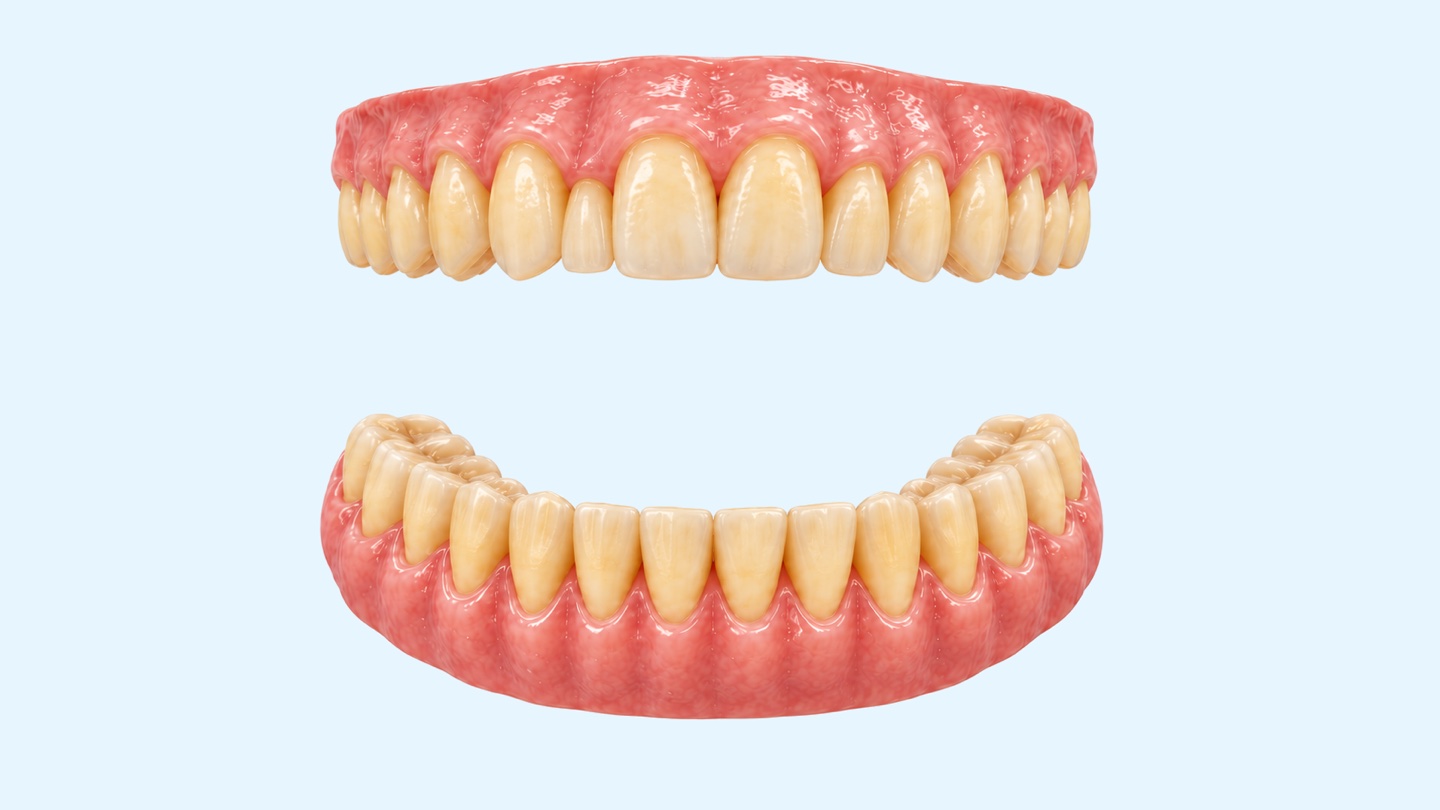 Teeth whitening in Istanbul: 3D illustration of upper and lower front teeth showing whitening at the clinic and at home