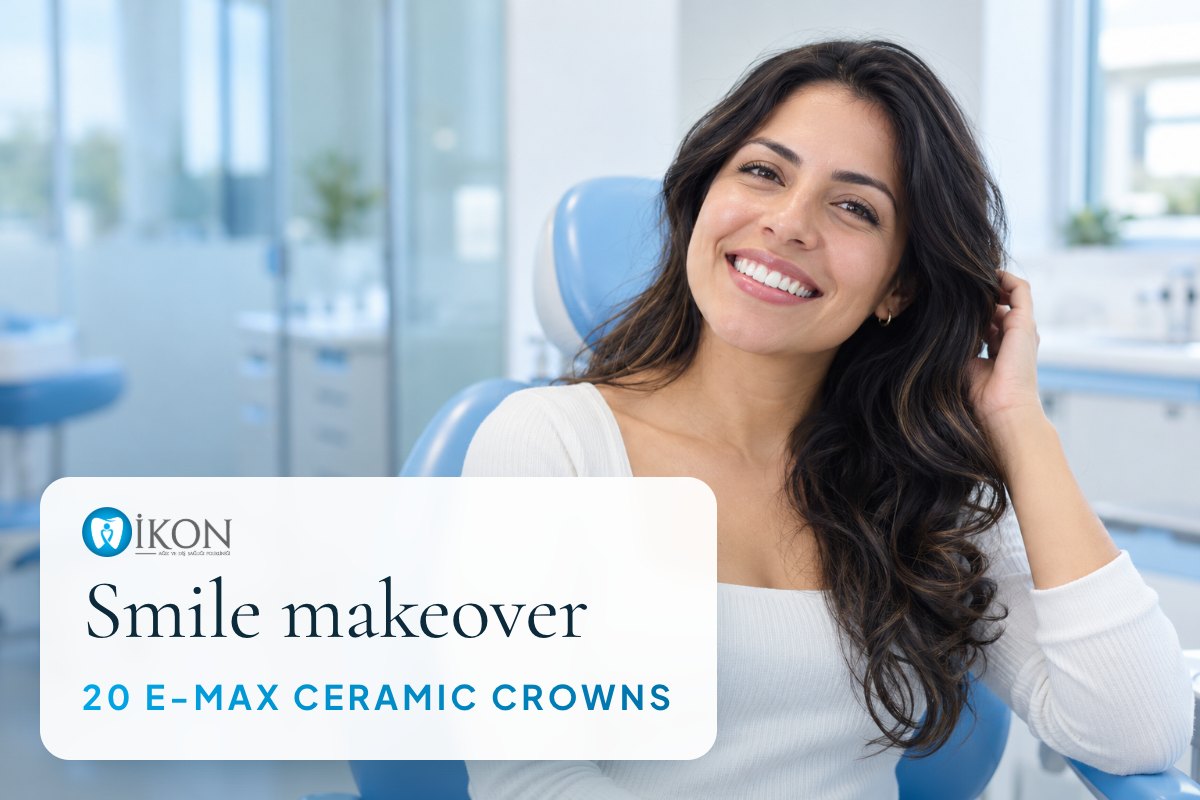 Smile makeover with 20 E-max ceramic crowns in Istanbul, Turkey (illustrative image, not a patient)