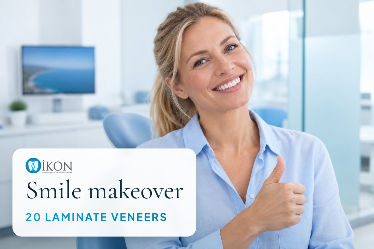 Smile makeover with 20 laminate veneers in Istanbul, Turkey (illustrative image, not a patient)