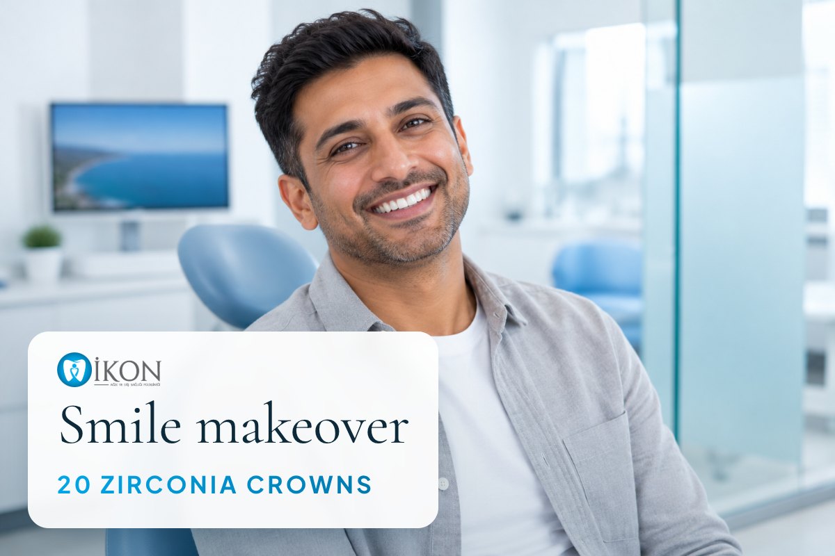 Smile makeover with 20 zirconia crowns in Istanbul, Turkey (illustrative image, not a patient)