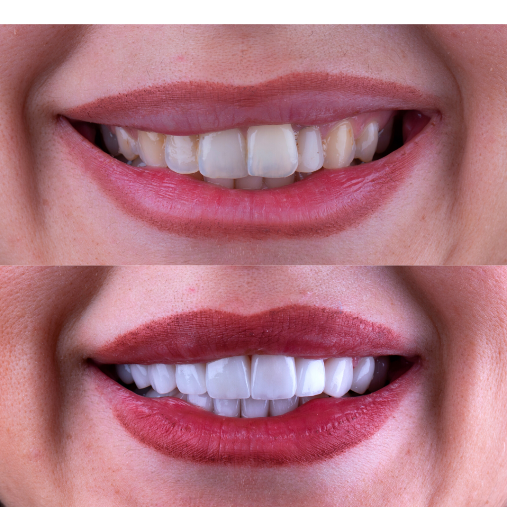 Dental travel kon di a z ve di sa l klini i